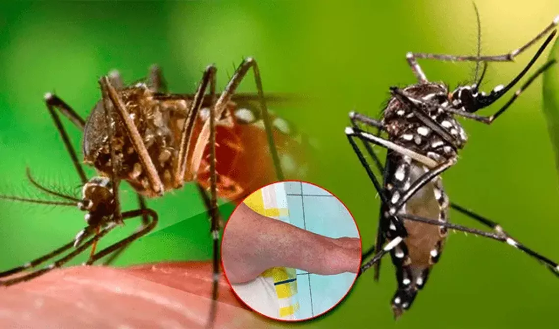 chikungunya